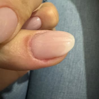 Aceleci Ve Tecrübesiz Hizmet Nedeniyle Yaşanan Tırnak Bakımı Sorunu