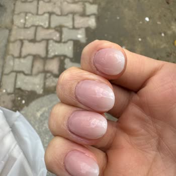 Aceleci Ve Tecrübesiz Hizmet Nedeniyle Yaşanan Tırnak Bakımı Sorunu