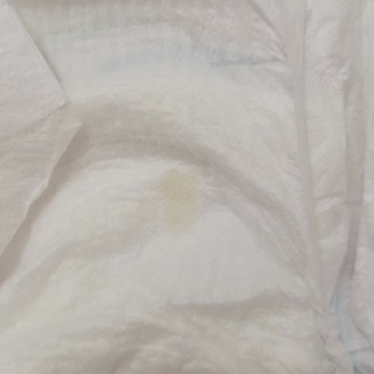 Bebek Bezinde Çıkan Leke Markaya Olan Güvenimi Sarstı, Acil Açıklama Bekliyorum