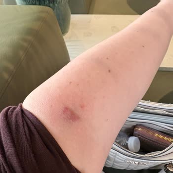 Kolan Hastanesi'nde Kan Alma Sırasında Yaşadığım Ağrılı Ve İlgisiz Yaklaşım Güvenimi Sarsıldı