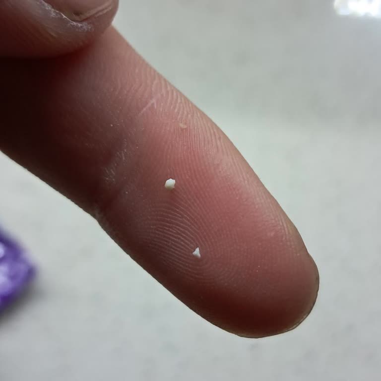 Sütaş Hüptrik Ürününde Pütürlü Yapı Ve Hijyen Endişesi Yaşadım