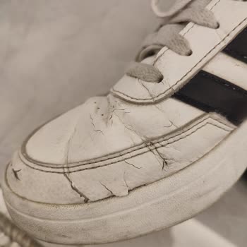 Kısa Sürede Deforme Olan Ayakkabı İçin Adil Çözüm Talebi