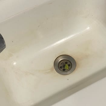 Kadın Doğum Servisinde Yetersiz Temizlik Ve Hijyen: Anne Ve Bebek Sağlığı Tehlikede