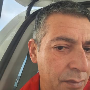 Göz Kapağı Ameliyatı Sonrası Kötüleşen Görünüm Ve Kalıcı İzler Nedeniyle Mağduriyet