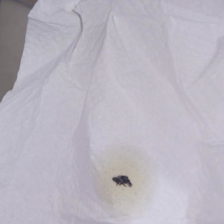 Selpak Havludan Çıkan Yabancı Madde Güvenimi Sarstı