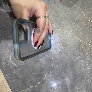 20 Günde Sararan Kılıf Kalite Vaadini Karşılamıyor İletişim De Yok