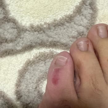 FLO Mağazasından Alınan Ayakkabı Ayak Sağlığımı Olumsuz Etkiledi, Değişim Talebim Reddedildi