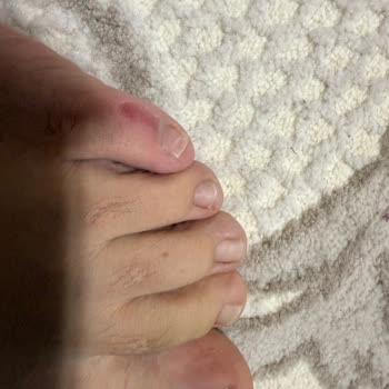 FLO Mağazasından Alınan Ayakkabı Ayak Sağlığımı Olumsuz Etkiledi, Değişim Talebim Reddedildi