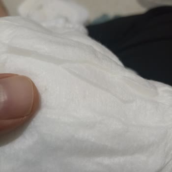 Çocuk Bezinde Yabancı Cisim: Hijyen Ve Güven Sorunu