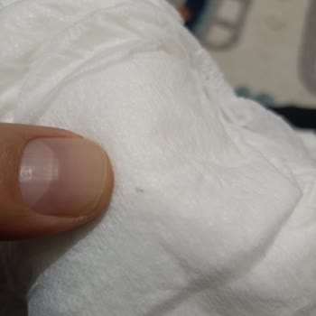 Çocuk Bezinde Yabancı Cisim: Hijyen Ve Güven Sorunu