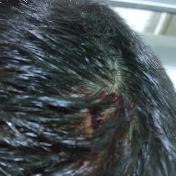 Okulda Yaşanan Şiddet Olayına Karşı İlgisizlik Ve Güvenlik Eksikliği