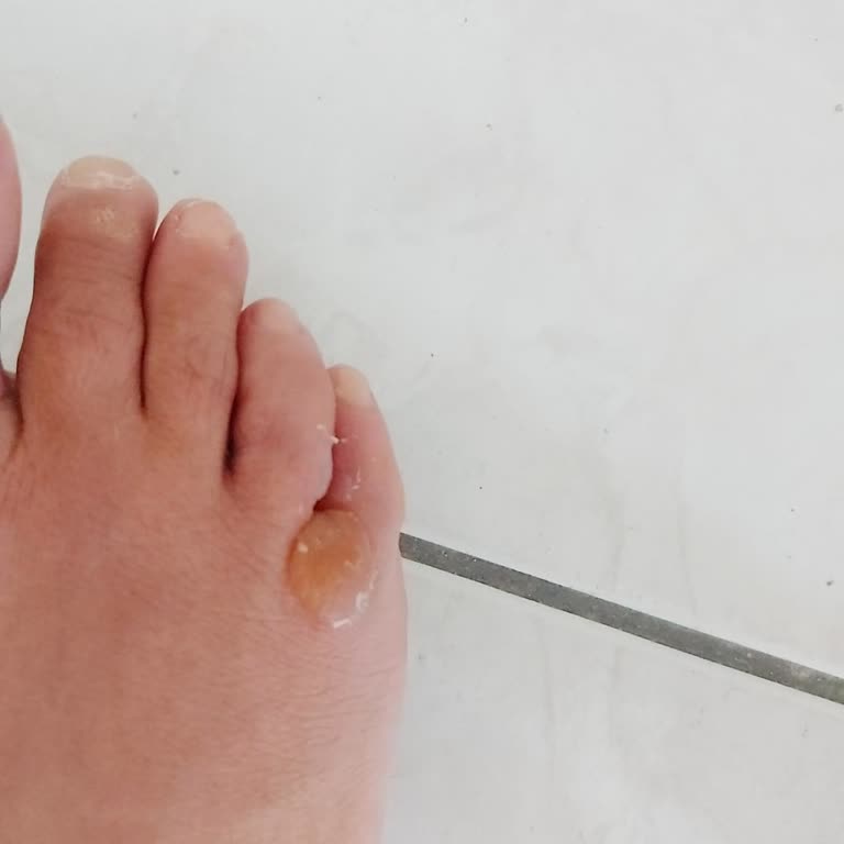 Skechers Rahatlatması Gereken Ayakkabı Ağrılarımı Artırdı