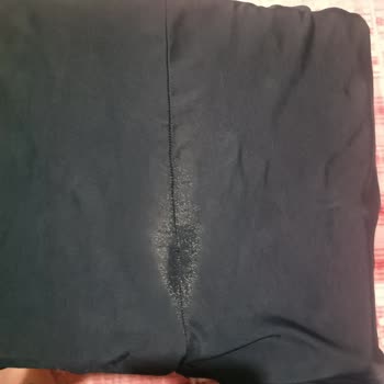 Kısa Sürede Deforme Olan Mayo Mağduriyeti