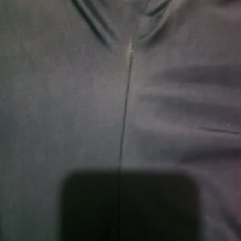 Kısa Sürede Deforme Olan Mayo Mağduriyeti