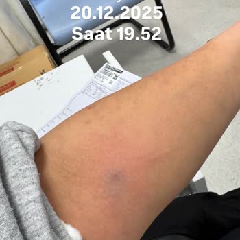 İzmir Bayraklı Şehir Hastanesi Acil Serviste Saygısız Ve Özensiz Müdahale Sonrası Mağduriyet