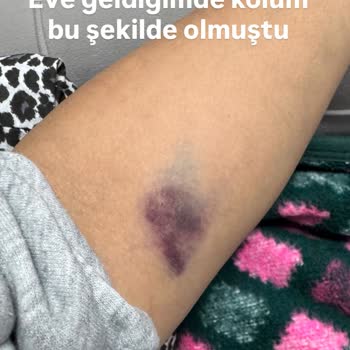 İzmir Bayraklı Şehir Hastanesi Acil Serviste Saygısız Ve Özensiz Müdahale Sonrası Mağduriyet