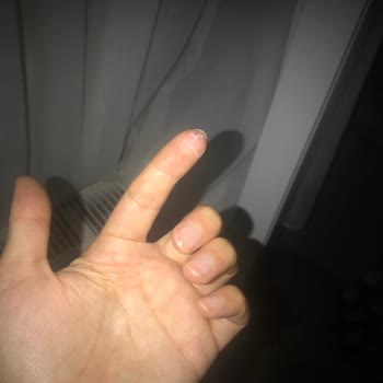 Sensodyne Diş Macunu Ve Fırçası Ağız Yarası Ve Hassasiyet Oluşturdu, Güvenim Sarsıldı