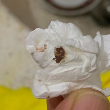 Çakır Termal Otel'de Böcek Ve Hijyen Sorunu Nedeniyle Konaklamamızı Yarıda Bırakmak Zorunda Kaldık