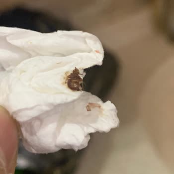 Çakır Termal Otel'de Böcek Ve Hijyen Sorunu Nedeniyle Konaklamamızı Yarıda Bırakmak Zorunda Kaldık