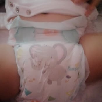 Prima Aktif Bebek 3 Numara Bezde Çiş Göstergesi Eksikliği Ve Ciddi Sızdırma Problemi