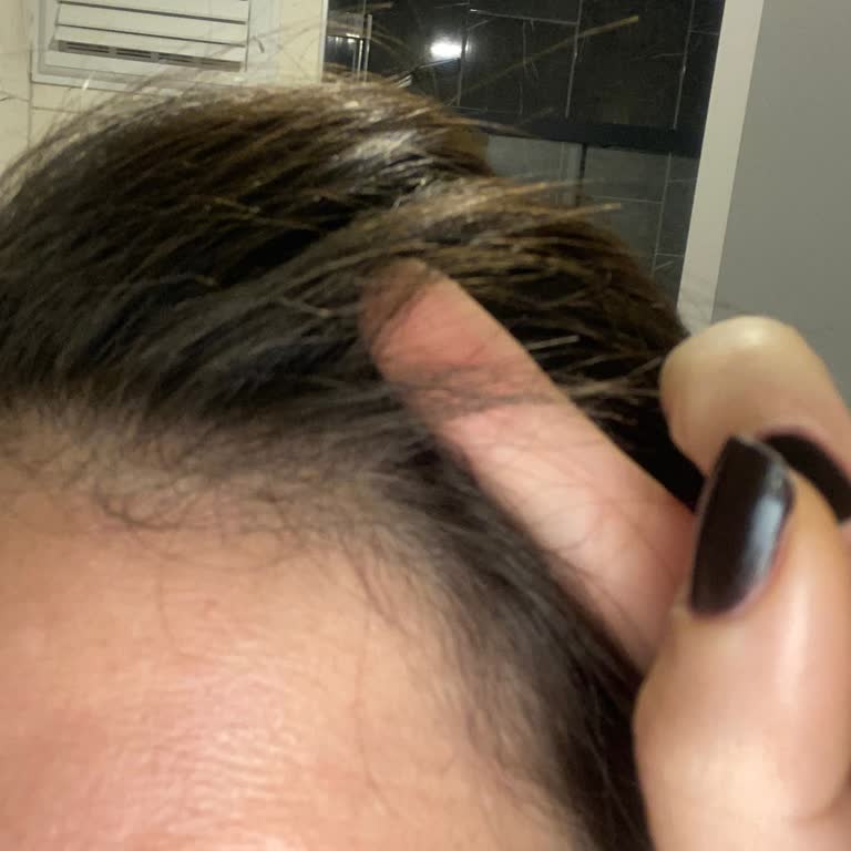 Saç Düzleştirici Saçlarımı Yaktı, Mağduriyetim Giderilmiyor!