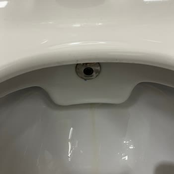 Yeni Alınan Klozetlerde Kısa Sürede Oluşan Sarı Lekeler Ve Yetersiz Servis