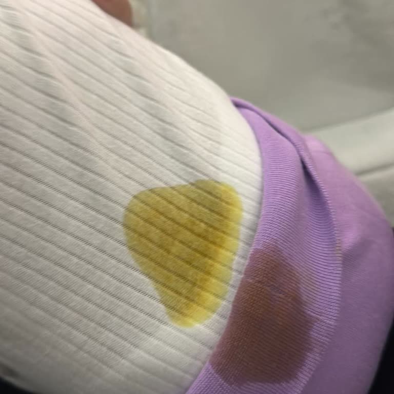 Prima Premium Care Bebek Bezinde Sürekli Kaka Taşması Sorunu