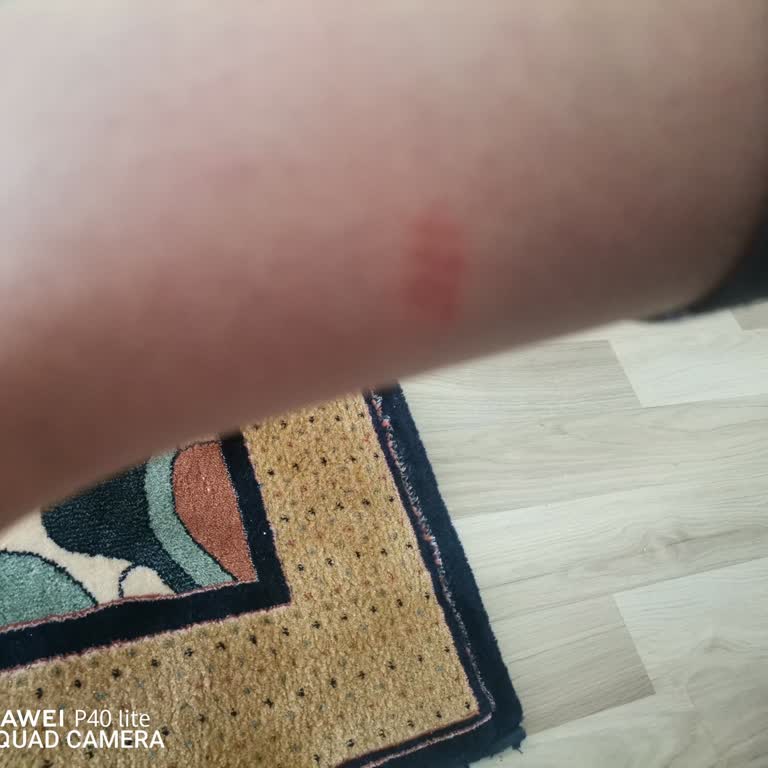 İlk Giyişte Bileklerimi Tahriş Eden Bot İçin İade Veya Değişim Talebim Reddedildi