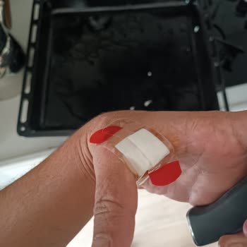 Jumbo Bıçak Seti Güvenlik Riski Ve Yaralanma Şikayeti