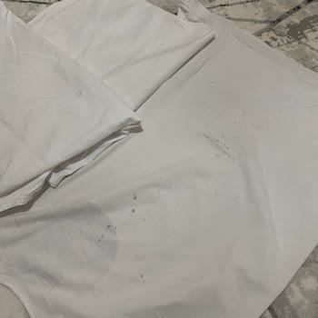 Çamaşır Makinesi Temiz Yıkamıyor, Servis Müdahalesi Sorunu Çözmedi