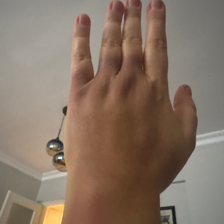 Memorial Ataşehir Hastanesi'nde Deneyimsiz Hemşireler Nedeniyle Yaşanan Kan Alma Mağduriyeti