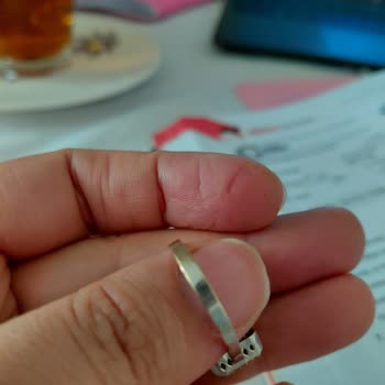 Aldığım Yüzükte Kısa Sürede Renk Solması Ve Garanti Belgesi Eksikliği