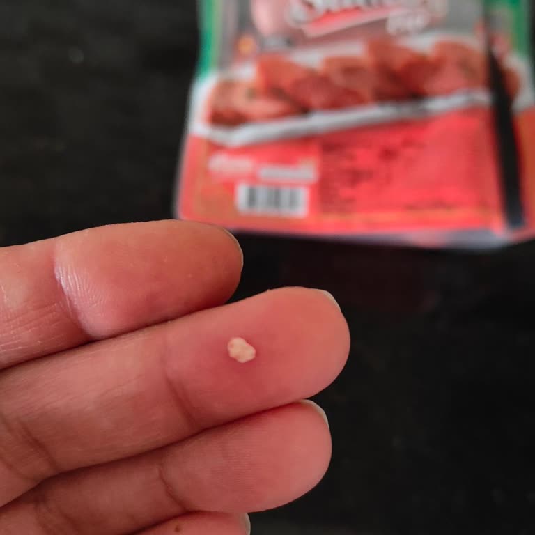 Sultan Dana Sucukta Çıkan Kemik Parçaları Kahvaltı Keyfimizi Bozdu