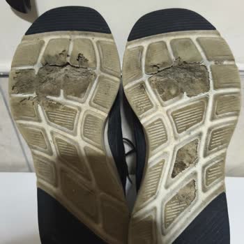 Kısa Sürede Deforme Olan Ayakkabı İçin Garanti Sürecinde Mağduriyet