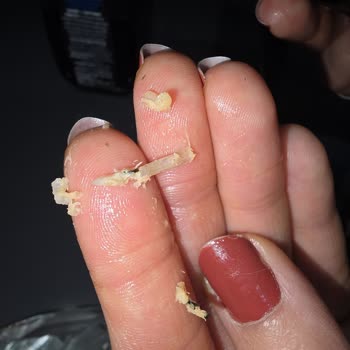 Dardanel Sushida Onigiri İçinde Kılçık Bulunca Güvenim Sarsıldı