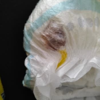 Molfix Bebek Bezinde Küf Ve İletişimsizlik Nedeniyle Yaşadığımız Sağlık Riski
