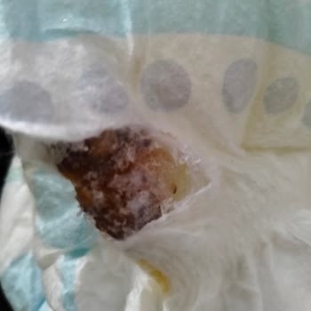 Molfix Bebek Bezinde Küf Ve İletişimsizlik Nedeniyle Yaşadığımız Sağlık Riski