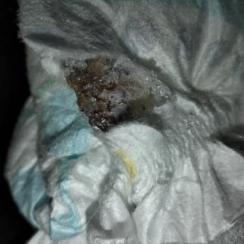 Molfix Bebek Bezinde Küf Ve İletişimsizlik Nedeniyle Yaşadığımız Sağlık Riski