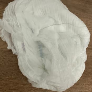 Hatalı Bebek Bezi Cilt Sorunlarına Yol Açtı, İade Talep Ediyorum