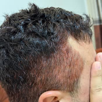 Saç Boyası Kutusundan Yanlış Renk Çıkması Nedeniyle Mağduriyet Ve Masraf Talebi