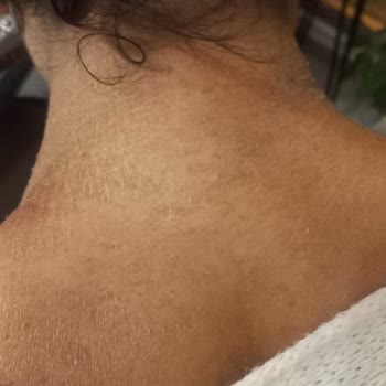 Sapanca Grand Wooden Havuzdaki Kimyasal Dengesizlik Nedeniyle Sağlık Sorunu Ve Ücret İade Talebi!