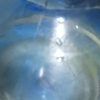 Kalabak Su Damacanasında Yosun Ve Hijyen Sorunu Endişesi