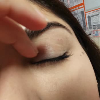 Dinç Güzellik & Kuaför Salonu Kaş Alımı İşlemi Sonrası Şişlik Ve Yaralar Oluştu!