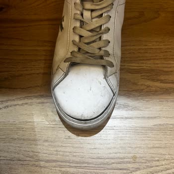 SuperStepten Alınan Ayakkabıda 4 Ayda Ciddi Deformasyon Ve Garanti Reddi Mağduriyeti