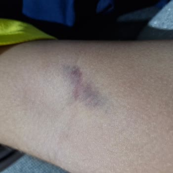 Aile Sağlığı Merkezleri Hemşirenin Çocuğuma Psikolojik Baskısı Ve Tehditkar Davranışı