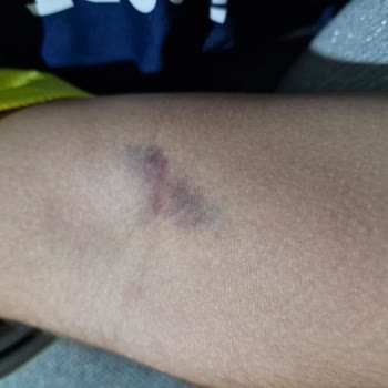 Aile Sağlığı Merkezleri Hemşirenin Çocuğuma Psikolojik Baskısı Ve Tehditkar Davranışı