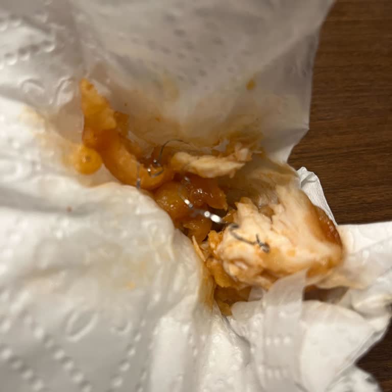 Yemekte Tel Parçası Çıkması Nedeniyle Hayal Kırıklığı Ve Güvenlik Endişesi