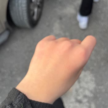 Öğretmenin Fiziksel Müdahalesi Nedeniyle Yaşadığım Mağduriyet