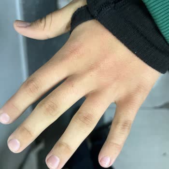 Öğretmenin Fiziksel Müdahalesi Nedeniyle Yaşadığım Mağduriyet