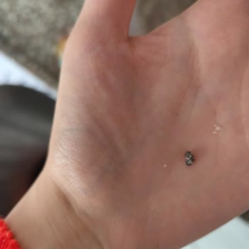 Türk Şeker Kristal Şeker Paketinden Çıkan Siyah Yabancı Maddeler Endişe Yarattı